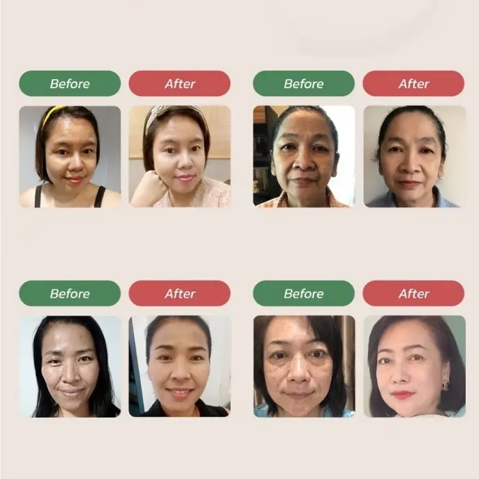 Before and After - Cleranico Snail Hydration Premium Cream | Better Than COSRX Visible results: Before and after using Cleranico Snail Hydration Premium Cream. Deep hydration, smoother texture, and glow within days. Outperforms popular snail creams like COSRX. A premium K-beauty moisturizer for sensitive, dry, or dull skin.